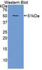 Proteasome 26S Subunit, ATPase 4 antibody, LS-C296083, Lifespan Biosciences, Western Blot image 