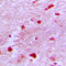 E2F Transcription Factor 2 antibody, LS-C352136, Lifespan Biosciences, Immunohistochemistry paraffin image 