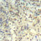 CFL1 antibody, LS-C335971, Lifespan Biosciences, Immunohistochemistry paraffin image 