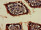 Vacuolar Protein Sorting 4 Homolog B antibody, LS-C680004, Lifespan Biosciences, Immunohistochemistry paraffin image 