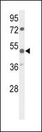 Parvin Alpha antibody, PA5-26326, Invitrogen Antibodies, Western Blot image 