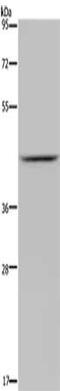 Jumonji Domain Containing 6, Arginine Demethylase And Lysine Hydroxylase antibody, CSB-PA988498, Cusabio, Western Blot image 