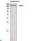 Thrombospondin 2 antibody, LS-C813522, Lifespan Biosciences, Western Blot image 