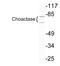 Choline O-Acetyltransferase antibody, LS-C199813, Lifespan Biosciences, Western Blot image 