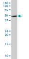 Transmembrane Protein With EGF Like And Two Follistatin Like Domains 2 antibody, H00023671-M08, Novus Biologicals, Western Blot image 