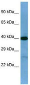 Twinfilin Actin Binding Protein 2 antibody, TA340173, Origene, Western Blot image 