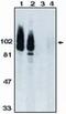 ADAM Metallopeptidase Domain 17 antibody, PA1-12517, Invitrogen Antibodies, Western Blot image 