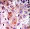 G Protein-Coupled Receptor Kinase 2 antibody, LS-C98902, Lifespan Biosciences, Immunohistochemistry frozen image 