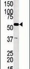 Glycerol Kinase 2 antibody, PA5-13925, Invitrogen Antibodies, Western Blot image 