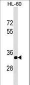 Era Like 12S Mitochondrial RRNA Chaperone 1 antibody, LS-C159543, Lifespan Biosciences, Western Blot image 