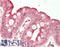 Interleukin 7 Receptor antibody, LS-B14261, Lifespan Biosciences, Immunohistochemistry paraffin image 