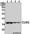 Palmitoyl-protein thioesterase 1 antibody, A02690, Boster Biological Technology, Western Blot image 