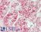 Translocator protein antibody, LS-B14234, Lifespan Biosciences, Immunohistochemistry paraffin image 