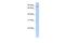 Mitochondrial TRNA Translation Optimization 1 antibody, A06009, Boster Biological Technology, Western Blot image 