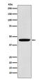 Pyruvate Dehydrogenase Kinase 1 antibody, M01268, Boster Biological Technology, Western Blot image 