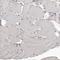 CDC42 Binding Protein Kinase Beta antibody, PA5-54613, Invitrogen Antibodies, Immunohistochemistry frozen image 