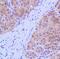 Arginase 1 antibody, PA5-32267, Invitrogen Antibodies, Immunohistochemistry frozen image 