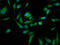 TOM1-like protein 1 antibody, LS-C673661, Lifespan Biosciences, Immunofluorescence image 