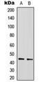 Sirtuin 2 antibody, abx133125, Abbexa, Western Blot image 