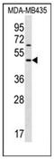 Keratocan antibody, AP52331PU-N, Origene, Western Blot image 