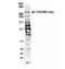 Chromodomain Helicase DNA Binding Protein 4 antibody, NB100-57519, Novus Biologicals, Western Blot image 