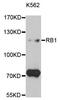 RB Transcriptional Corepressor 1 antibody, MBS125394, MyBioSource, Western Blot image 