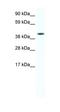 Forkhead Box F1 antibody, orb324678, Biorbyt, Western Blot image 