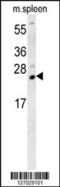 Transmembrane And Ubiquitin Like Domain Containing 1 antibody, 62-107, ProSci, Western Blot image 