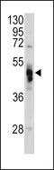 Galactosidase Alpha antibody, LS-C166494, Lifespan Biosciences, Western Blot image 