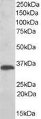 Thioredoxin Related Transmembrane Protein 1 antibody, MBS421269, MyBioSource, Western Blot image 