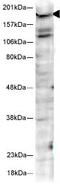 Huntingtin antibody, ab2174, Abcam, Western Blot image 