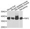 Fructose-Bisphosphatase 2 antibody, A04867, Boster Biological Technology, Western Blot image 