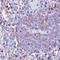 Protein Phosphatase 1 Catalytic Subunit Gamma antibody, orb74174, Biorbyt, Immunohistochemistry paraffin image 
