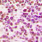 POU Class 2 Homeobox 2 antibody, LS-C352689, Lifespan Biosciences, Immunohistochemistry paraffin image 