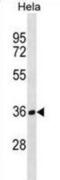 Tubulin Folding Cofactor B antibody, abx030766, Abbexa, Western Blot image 