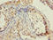 Thyroid Hormone Receptor Interactor 12 antibody, LS-C676649, Lifespan Biosciences, Immunohistochemistry paraffin image 