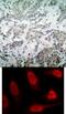 p53 antibody, 79-318, ProSci, Immunohistochemistry paraffin image 