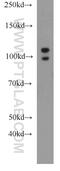 Aldehyde Dehydrogenase 1 Family Member L2 antibody, 21391-1-AP, Proteintech Group, Western Blot image 