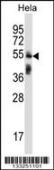 Tripartite Motif Containing 38 antibody, MBS9204523, MyBioSource, Western Blot image 