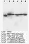 DNA nucleotidylexotransferase antibody, LS-C172022, Lifespan Biosciences, Western Blot image 