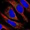 Transmembrane anterior posterior transformation protein 1 antibody, PA5-65524, Invitrogen Antibodies, Immunofluorescence image 