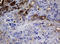 NME/NM23 Nucleoside Diphosphate Kinase 1 antibody, LS-C175587, Lifespan Biosciences, Immunohistochemistry paraffin image 