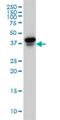 Eukaryotic Translation Initiation Factor 4E Family Member 2 antibody, H00009470-M02, Novus Biologicals, Western Blot image 