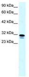Single Stranded DNA Binding Protein 2 antibody, TA329410, Origene, Western Blot image 