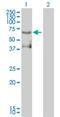 ETS Variant 4 antibody, H00002118-M01, Novus Biologicals, Western Blot image 