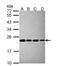Proteasome Subunit Beta 5 antibody, NBP2-19983, Novus Biologicals, Western Blot image 