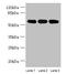 Serine/Threonine Kinase 33 antibody, CSB-PA861179LA01HU, Cusabio, Western Blot image 