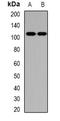 Patatin Like Phospholipase Domain Containing 3 antibody, LS-B15640, Lifespan Biosciences, Western Blot image 