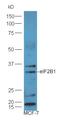 Eukaryotic Translation Initiation Factor 3 Subunit D antibody, orb183252, Biorbyt, Western Blot image 