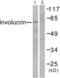 Involucrin antibody, abx013116, Abbexa, Western Blot image 